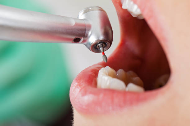 Best Holiday Emergency Dentist in Buffalo, SC